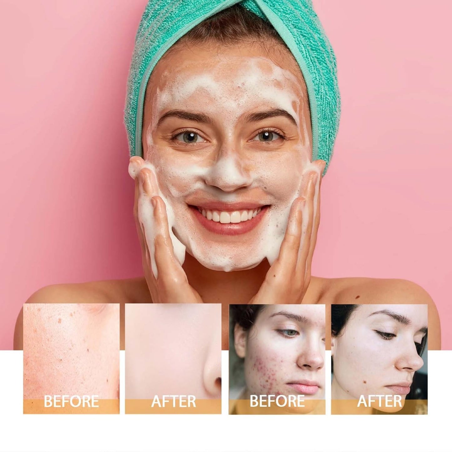 Turmeric Facial Cleanser with Soft Brush – Deep Foaming Face Wash for Brightening, Acne Control & Glowing Skin (100ml)