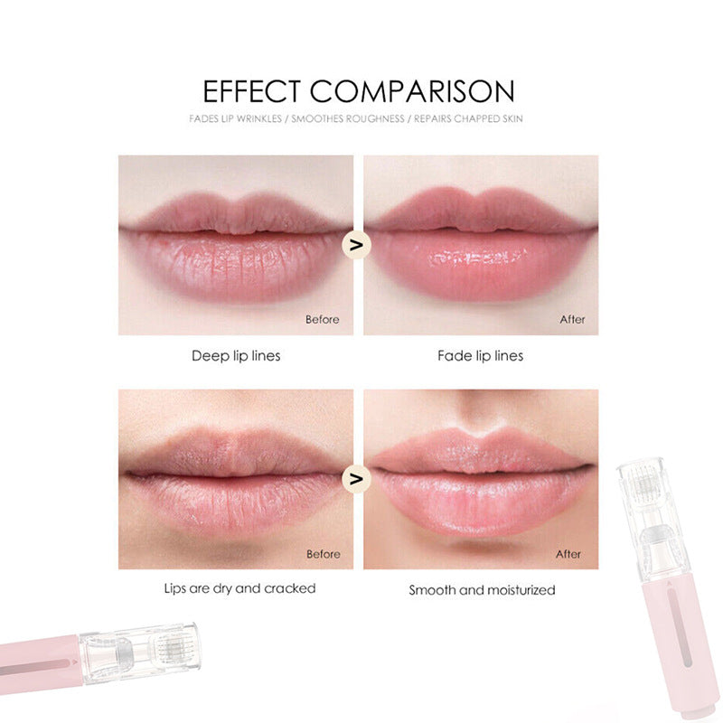 Lip Care Roller – Portable Manual Microneedling Tool for Serum Absorption (Mini & Fashion Design)